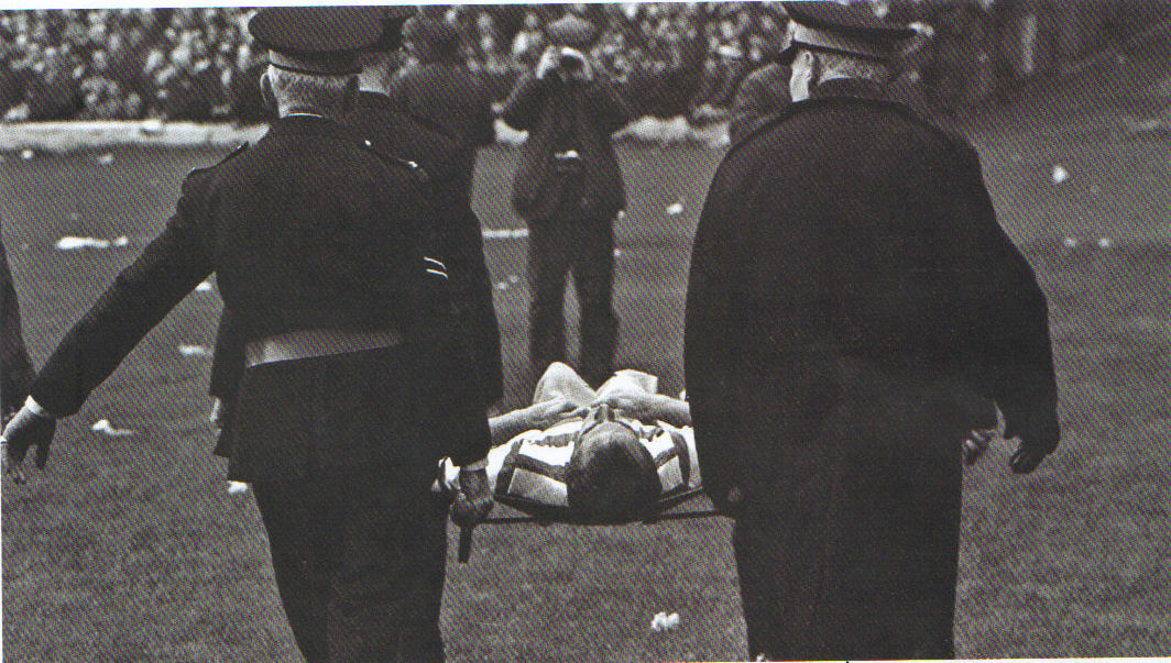 Steve Chalmers is carried off with a broken leg 1969 LCF