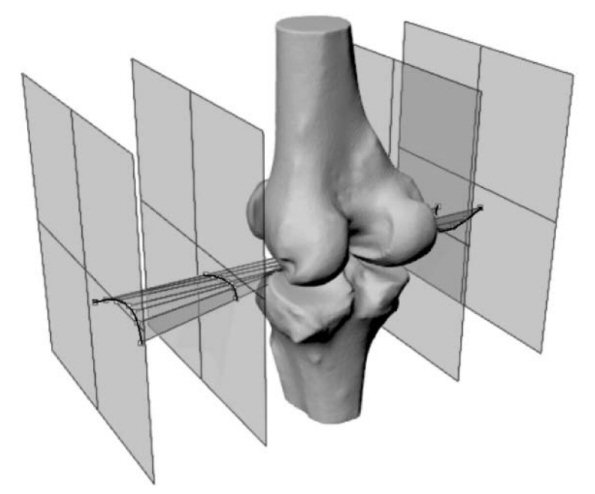Analysis of knee biomechanics, geometry and kinematics - White-Smoke Analysis of knee biomechanics, geometry and kinematics - White-Smoke