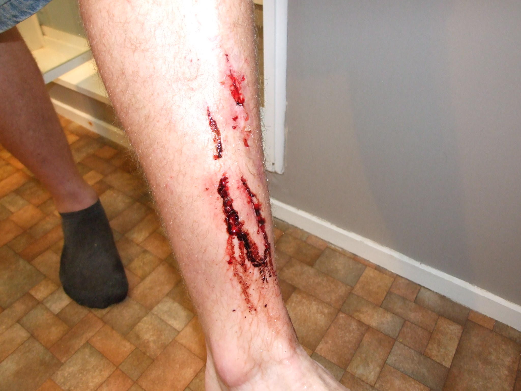 another slipped pedal another slipped pedal